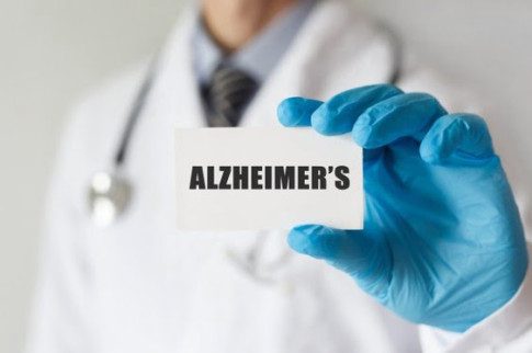 Alzheimer’s Diagnosis