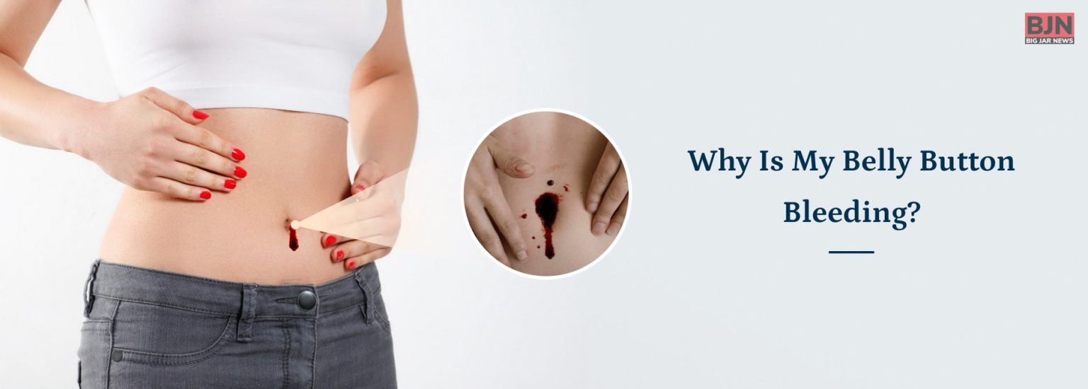 Why Is My Belly Button Bleeding? Must Read