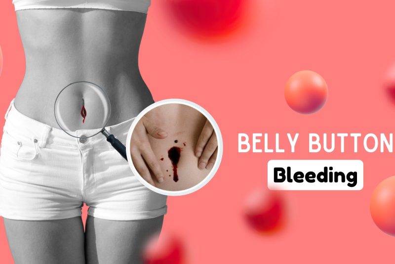 Belly Button Bleeding Probable Causes, Symptoms, & Treatment