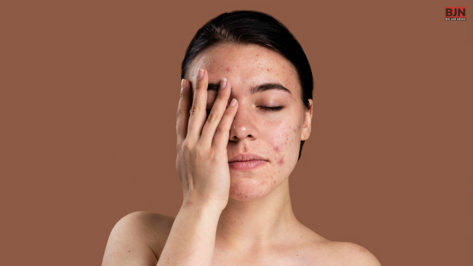 Let's Discuss About What are the Causes of Sensitive Skin