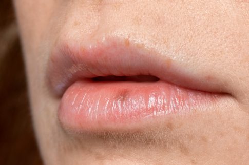 lip pigmentation