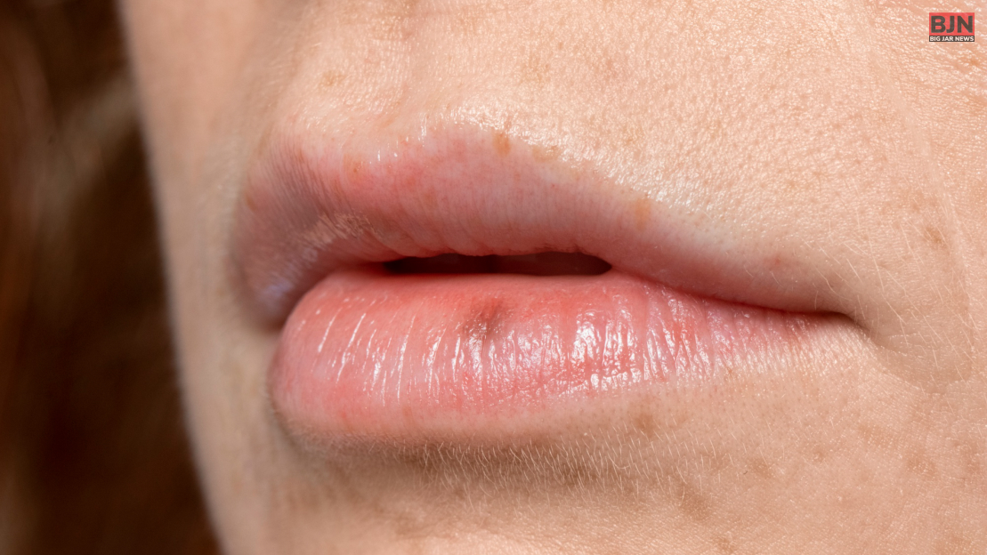 lip pigmentation